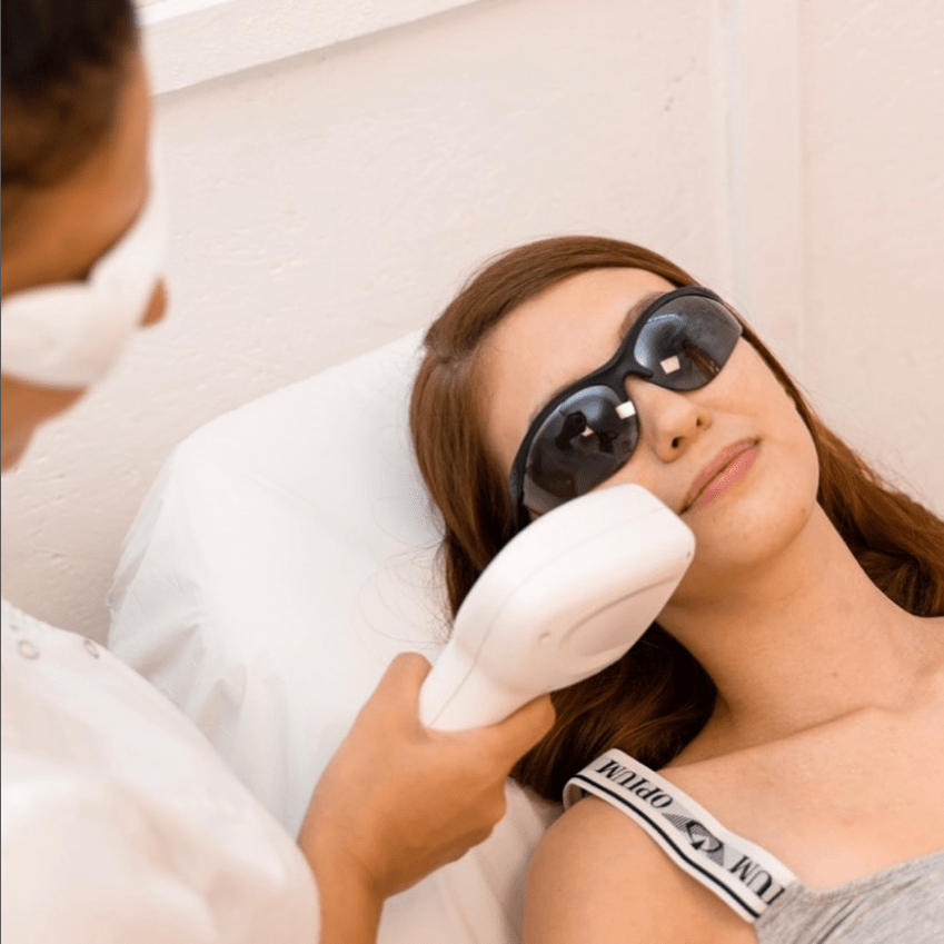 Как подготовить кожу перед лазерной эпиляцией лица